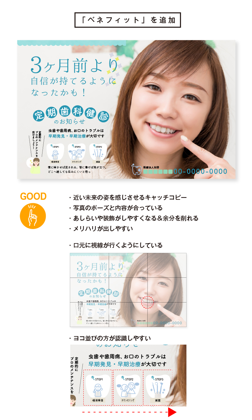 ベネフィットを追加